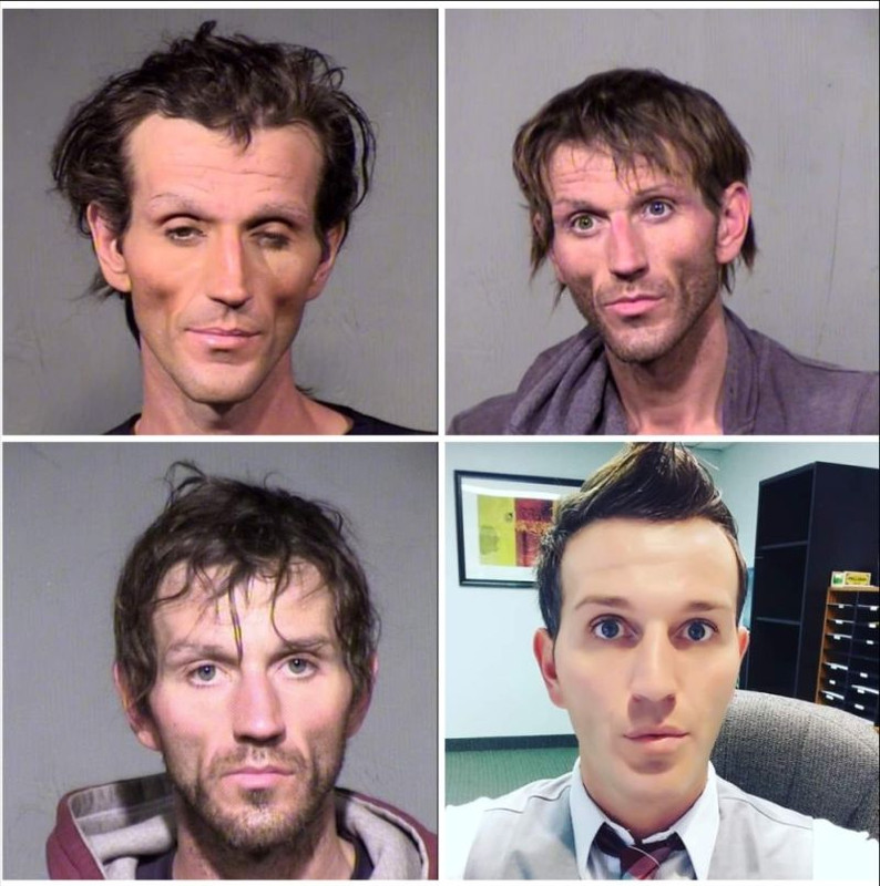 Fascinating Photos -  Before and After recovery from Meth addiction