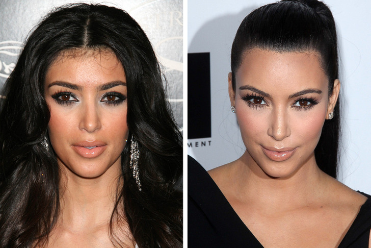 Celebrities Who Regret Plastic Surgery - Kim Kardashian