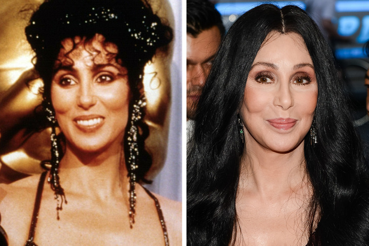 Celebrities Who Regret Plastic Surgery - Cher