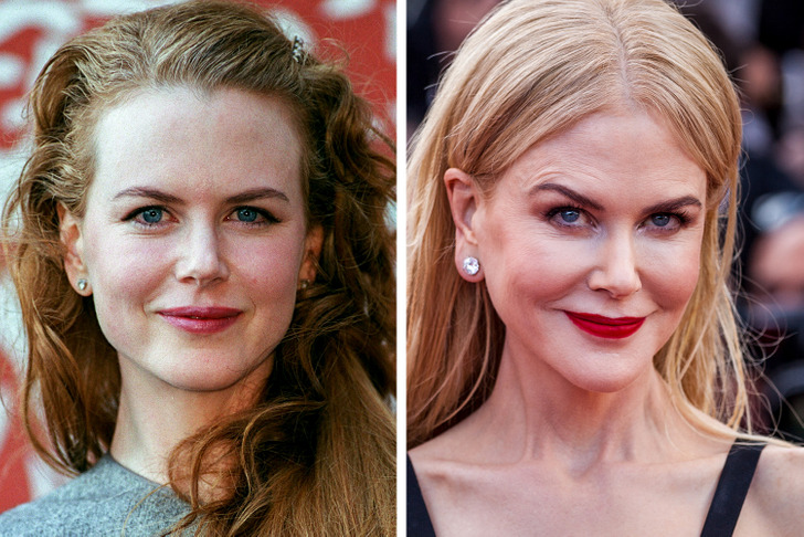 Celebrities Who Regret Plastic Surgery - Nicole Kidman