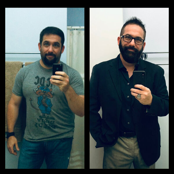 before and after transfomations -beard
