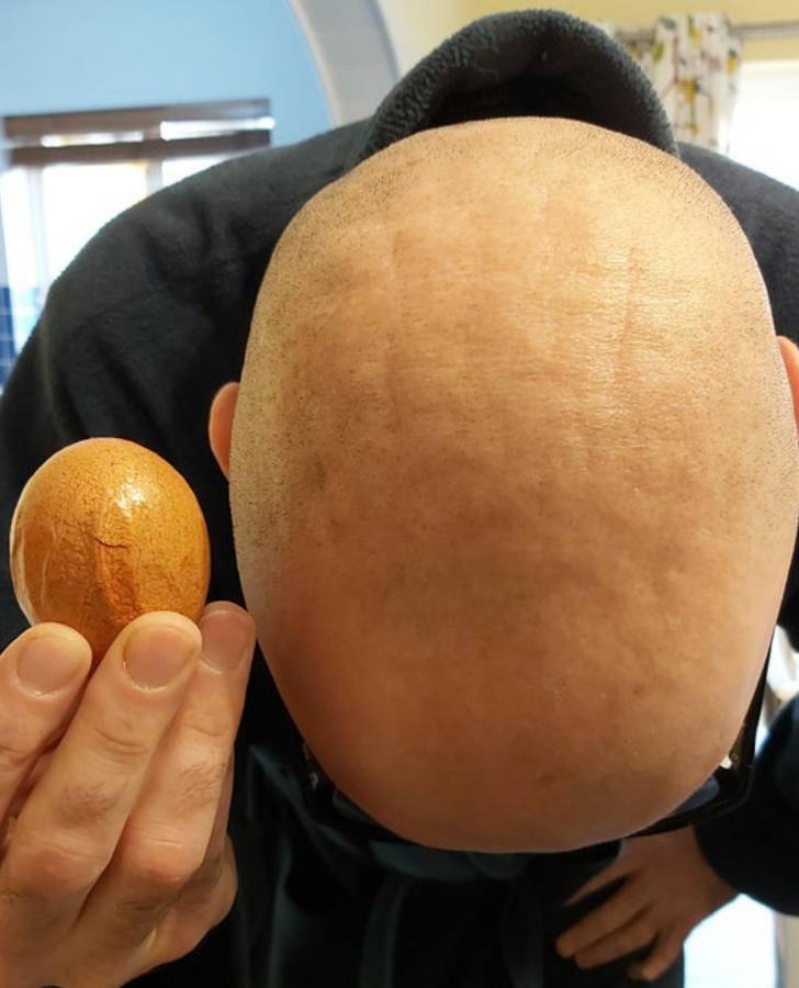 “This weird wrinkly egg matches my husband’s weird wrinkly head.”