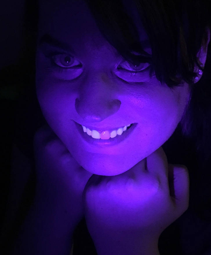 “Discovered today that my fake front tooth doesn’t glow under a black light.”