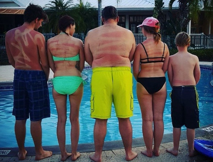 “My friends’ first time in the Florida sun. It was also their first time using sunscreen spray.”