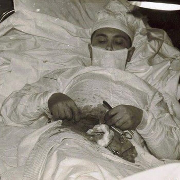 fascinating photos form history  - He Man Who Cut Out His Own Appendix