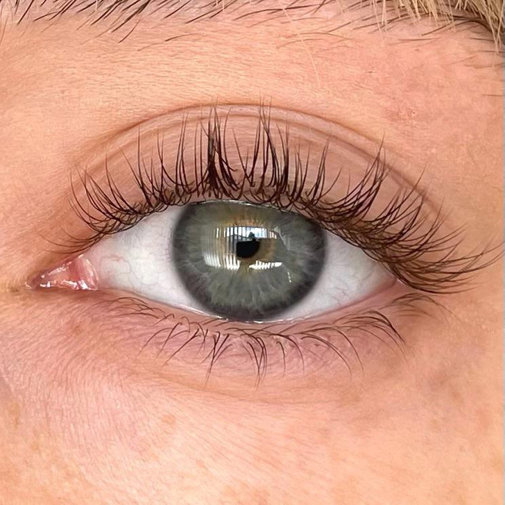 rare human features - double row of eyelashes - wer