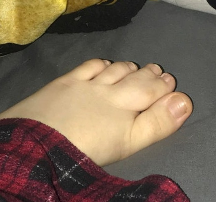 rare human features - toe