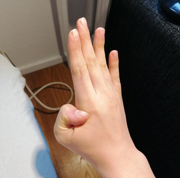 rare human features - bending thumb backwards