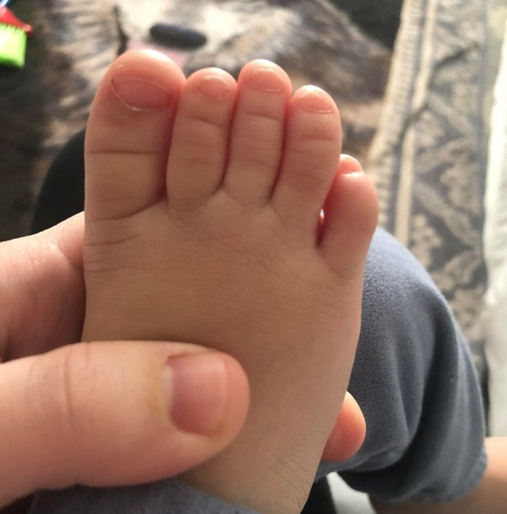 rare human features - third toe longest