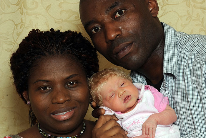 that In 2010, a black Nigerian couple living in London gave birth to a white, blond haired & blue eyed baby that they called 'The Miracle Baby'.