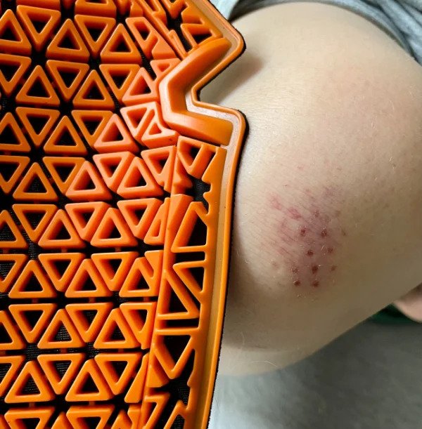 “I was in a motorcycle accident and my gear did such a good job that my only skin injury was a knee armor imprint.”