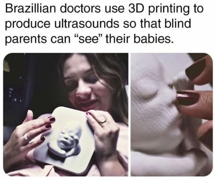 cool things - photo caption - Brazillian doctors use 3D printing to produce ultrasounds so that blind parents can "see" their babies.