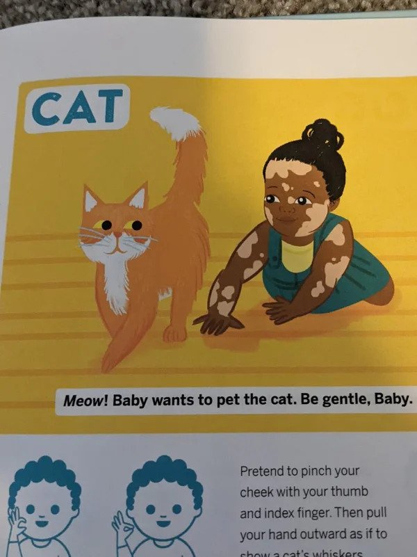 “This book uses a drawing of a baby with vitiligo.”