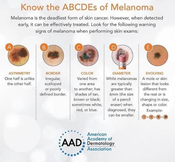 useful charts - infographics - Know the ABCDEs of Melanoma Melanoma is the deadliest form of skin cancer. However, when detected early, it can be effectively treated. Look for the ing warning signs of melanoma when performing skin exams A B E Asymmetry On