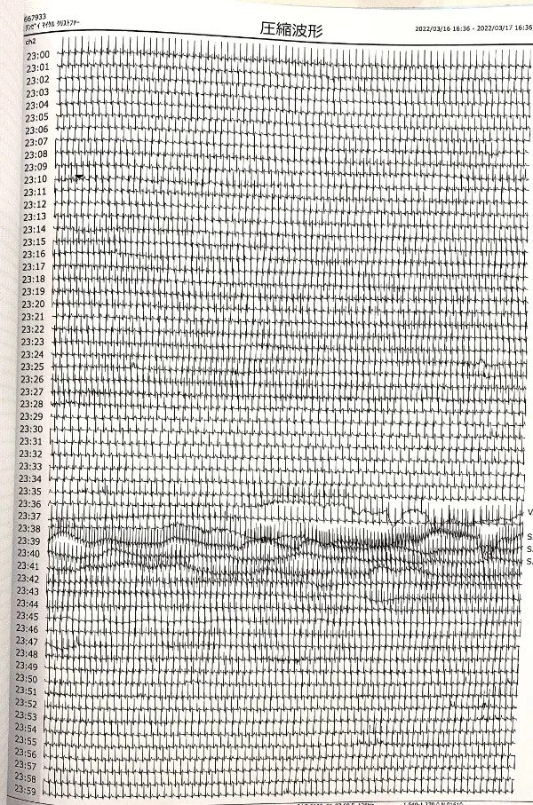 “I happened to be wearing a heart monitor during the 7.4 magnitude earthquake in Japan last month. Just got the records back today.”