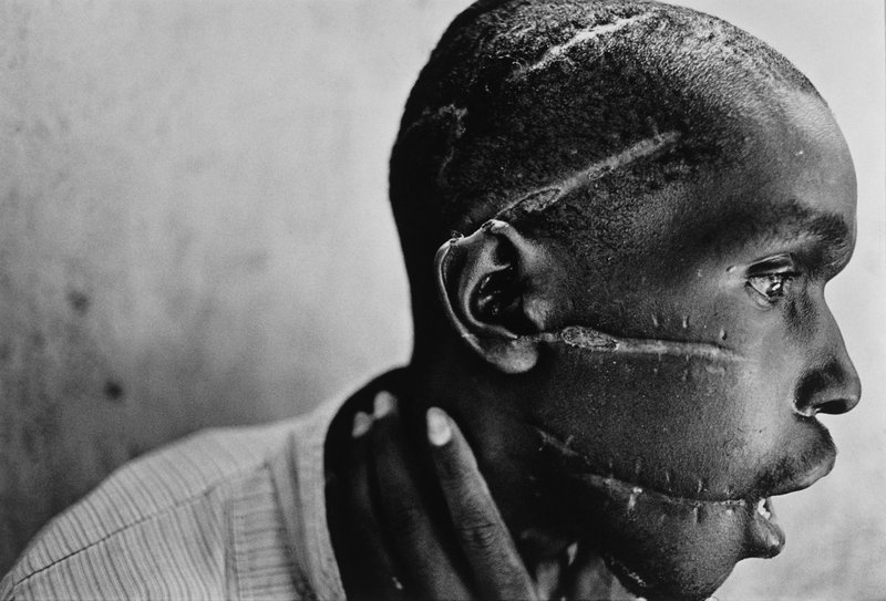“Rwanda, 1994” by James Nachtwey. A Hutu man who did not support the genocide had been imprisoned in the concentration camp, starved and attacked with machetes