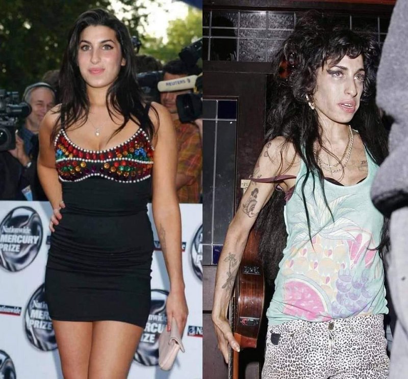 Amy Winehouse — before and after addiction