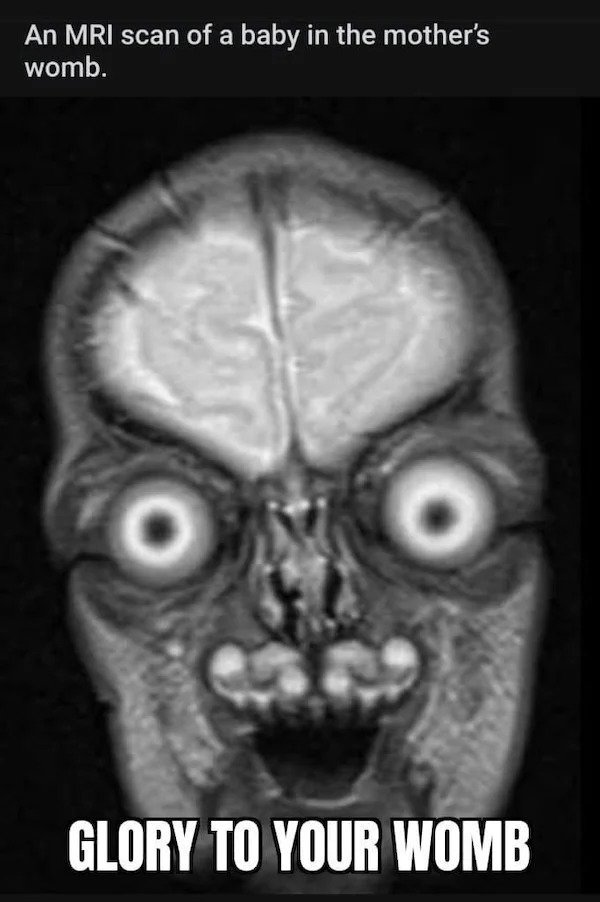 Cursed Images - baby mri face - An Mri scan of a baby in the mother's womb. Glory To Your Womb
