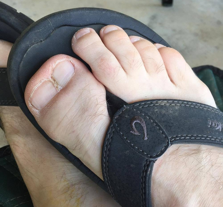 “A buddy of mine has a double big toe.”