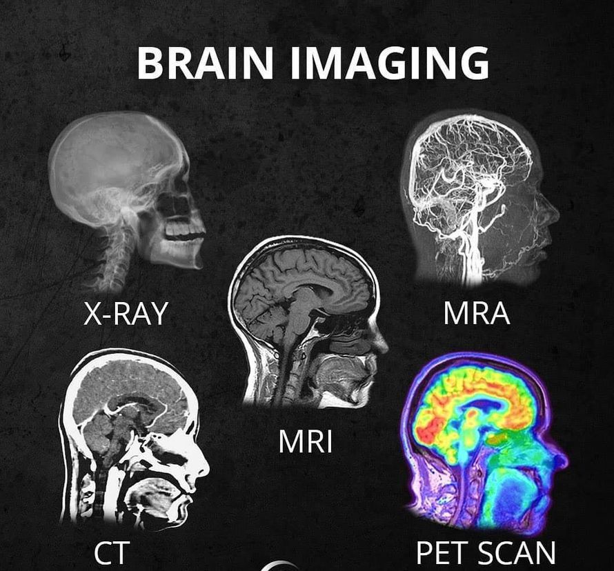 fascinating things found - different types of scans for brain - Brain Imaging XRay Mra Mri Pet Scan