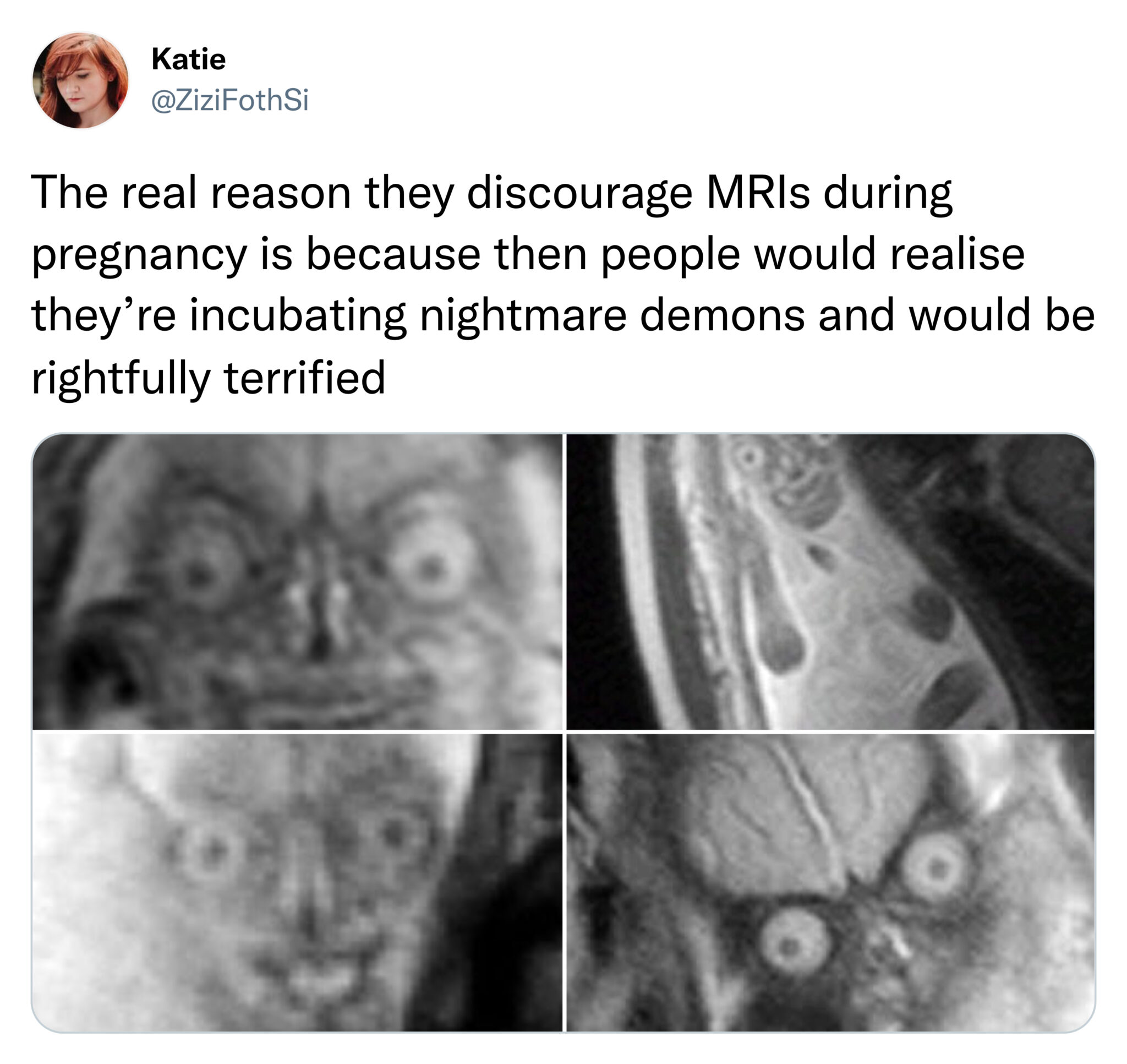 funny tweets and memes -  fetus mri meme - Katie The real reason they discourage MRIs during pregnancy is because then people would realise they're incubating nightmare demons and would be rightfully terrified