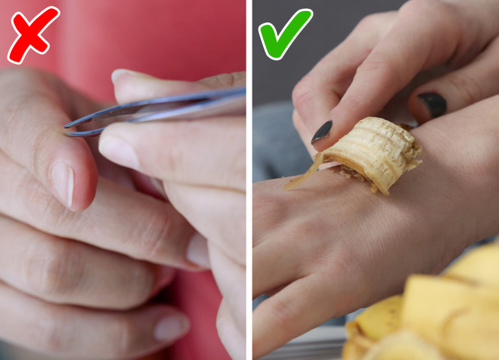 If you have a splinter in your skin, wrap banana peel around it and secure it with tape. You’ll be able to easily remove the splinter in a few hours.