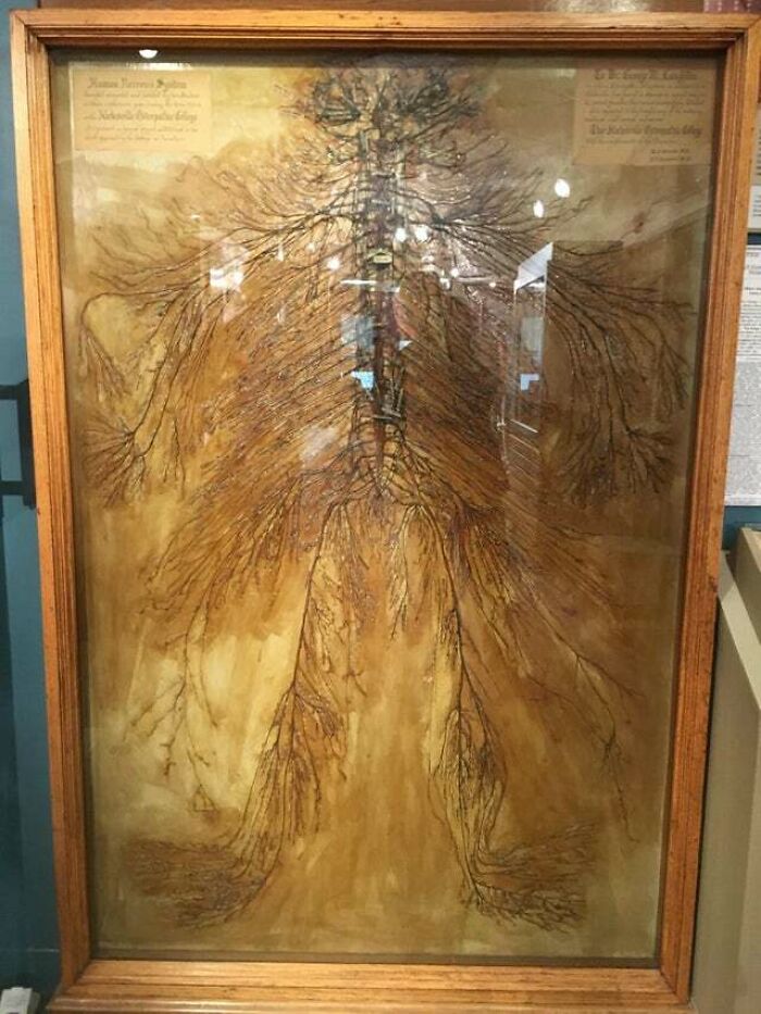 This is an intact human nervous system that was dissected by two medical students in 1925. It took them over 1500 hours. There are only 4 of these in the world