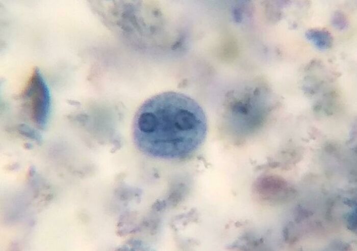 This amoeba I saw through the microscope