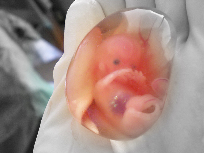 body facts - actual 10 week fetus