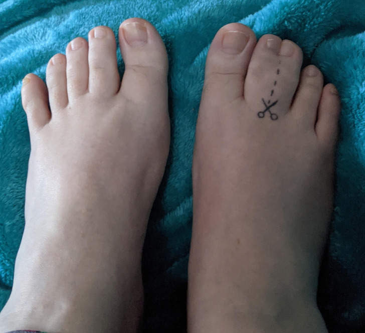 “Behold my webbed toe tattoo!”