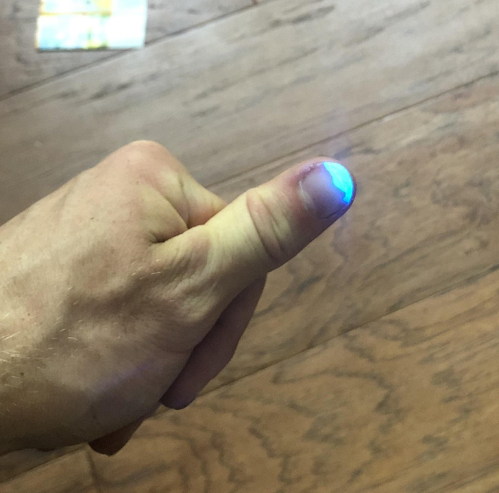 “I always wear some clear nail polish that strongly fluoresces. When I’m outside and I see some blue on my thumb, I know the UV index is high and it’s sunscreen time.” “In the photo, I shined a UV flashlight on the nail polish to exaggerate it. In reality, there is a slight blue tint.”