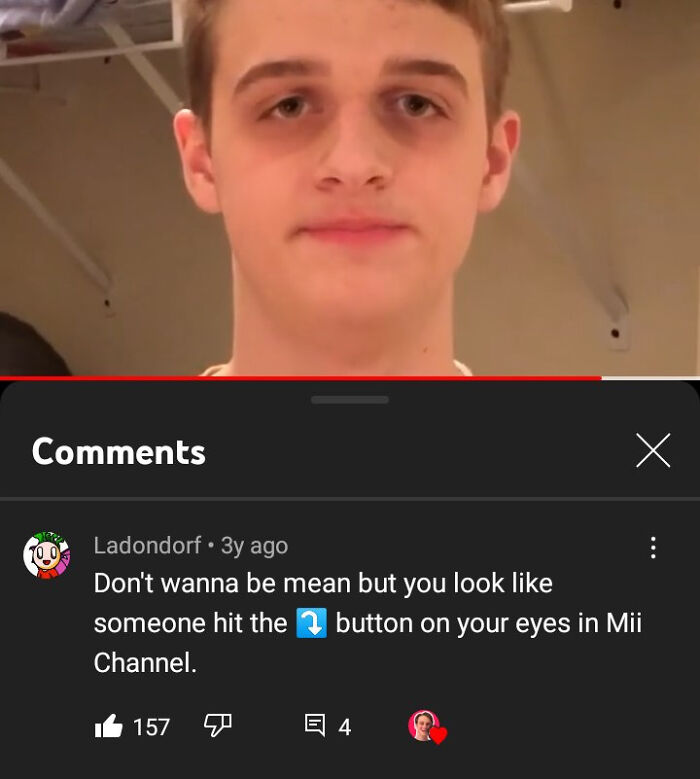 Comment roasts - Don't wanna be mean but you look someone hit the button on your eyes in Mii Channel.