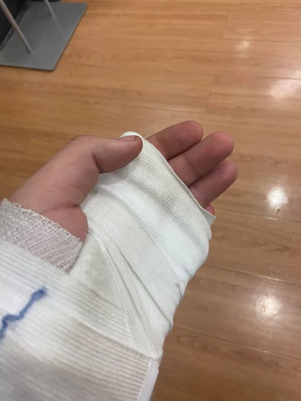 “Broke my finger at work, got fired after the drug test. All at the end of a 12 hour night shift”