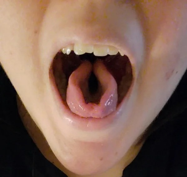 genetic anomalies - cool mutations - tongue