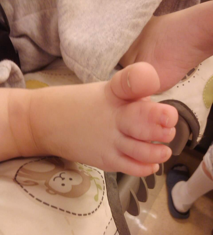 “This baby’s signature webbed toes”