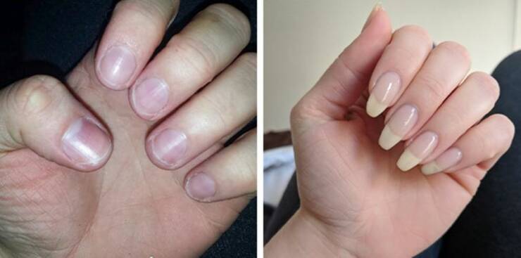 “My nail growth progress! If I can do it, anyone can!”