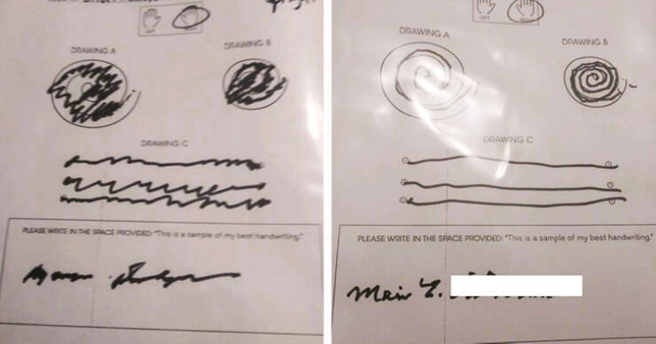 “My 90-year-old grandmother’s handwriting before and after her focused ultrasound essential tremor treatment”