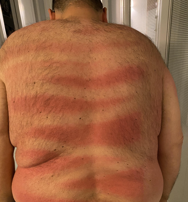 “First day at the beach and my wife made sure I was protected from the sun by spraying my back with sunscreen.”