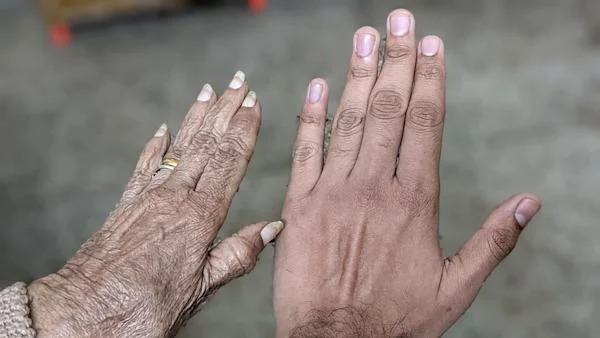 My grandma’s hand next to mine. Over 60 years of age difference!