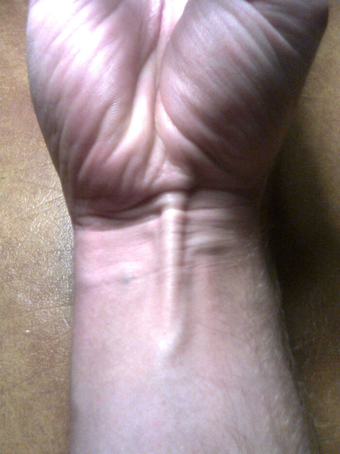 There is a muscle, called palmaris longus, in the forearm missing in about 10% of the population. You can easy test if you have it by putting your pinky and thumb together, while holding your palm facing up, and flex the hand upwards. If 1 tendon is standing out more than the others that's palmaris longus.