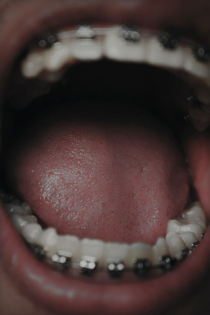 Different parts of your tongue don't actually detect different types of taste. Your tongue is the same all over.