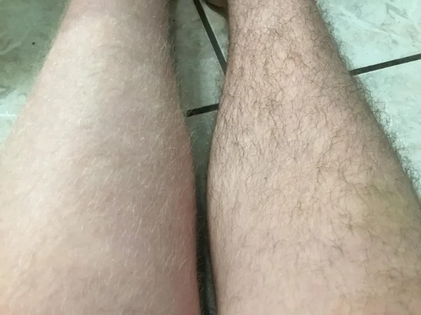 “The hair on my left leg is blonde, while the hair on the right is black.”