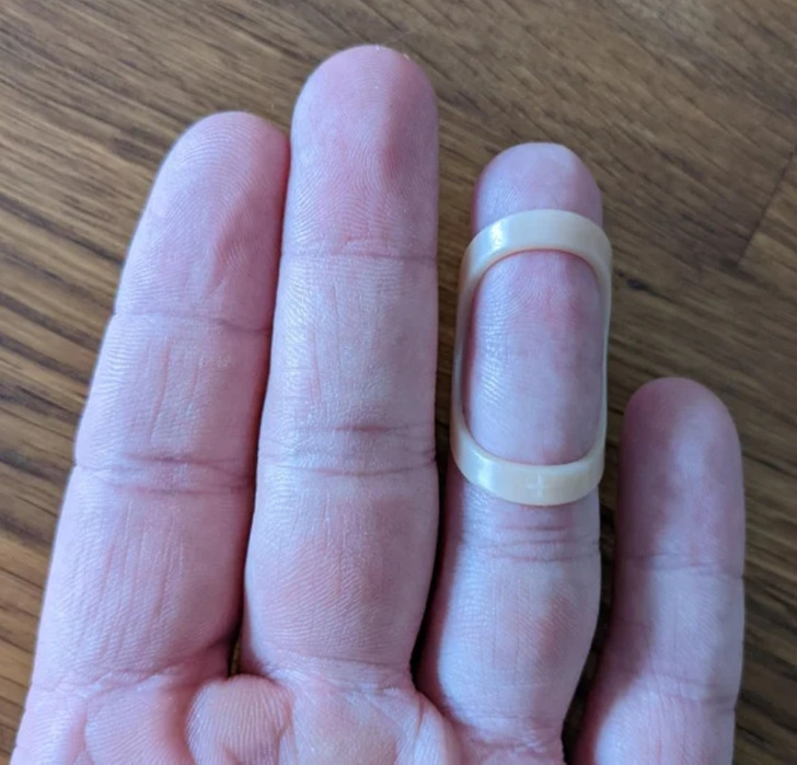 “Starting to lose the first joint crease on my ring finger after being splinted for 7 weeks.”