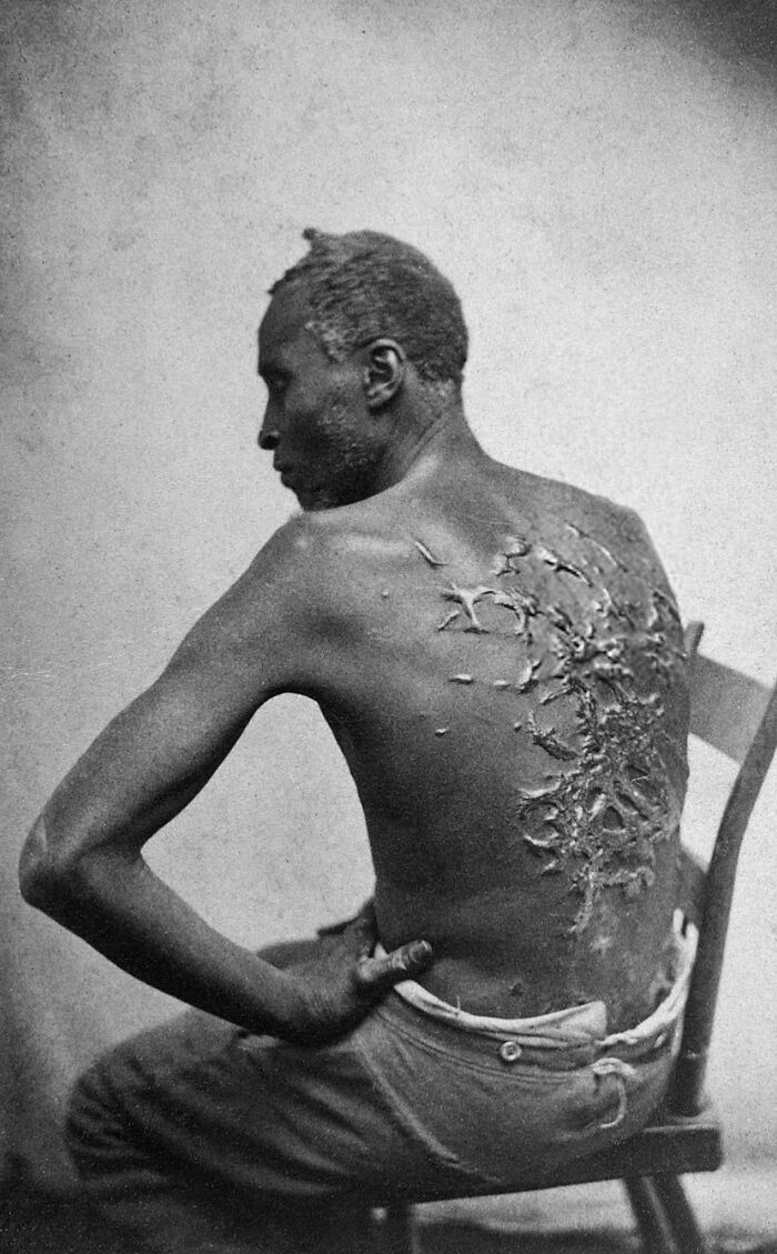 Runaway Slave Peter, Exposing His Severely Whipped Back. Peter had received a severe whipping for undisclosed reasons in the fall of 1862. Peter escaped in March 1863 from the 3,000 acre plantation of John & Bridget Lyons, who held him and 40 other people in slavery at the time of the 1860 census.

Baton Rouge, La., 2 April, 1863: "Overseer Artayou Carrier whipped me. I was two months in bed sore from the whipping. My master come after I was whipped; he discharged the overseer. The very words of poor Peter, taken as he sat for his picture."