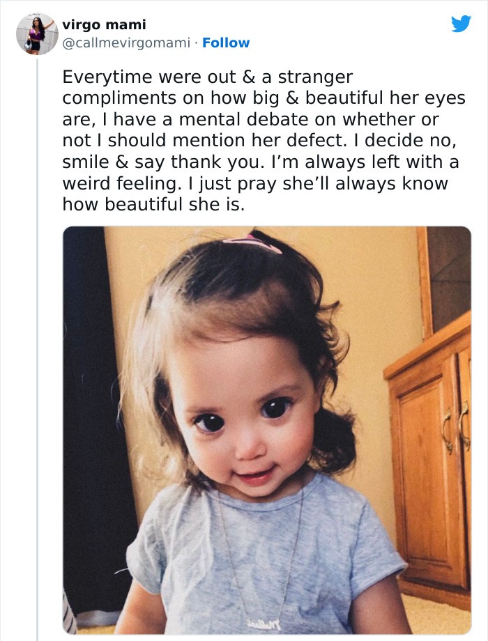 This Little Girl's Big, Beautiful Eyes Are Due To A Rare Genetic Syndrome Called Axenfeld-Rieger Syndrome