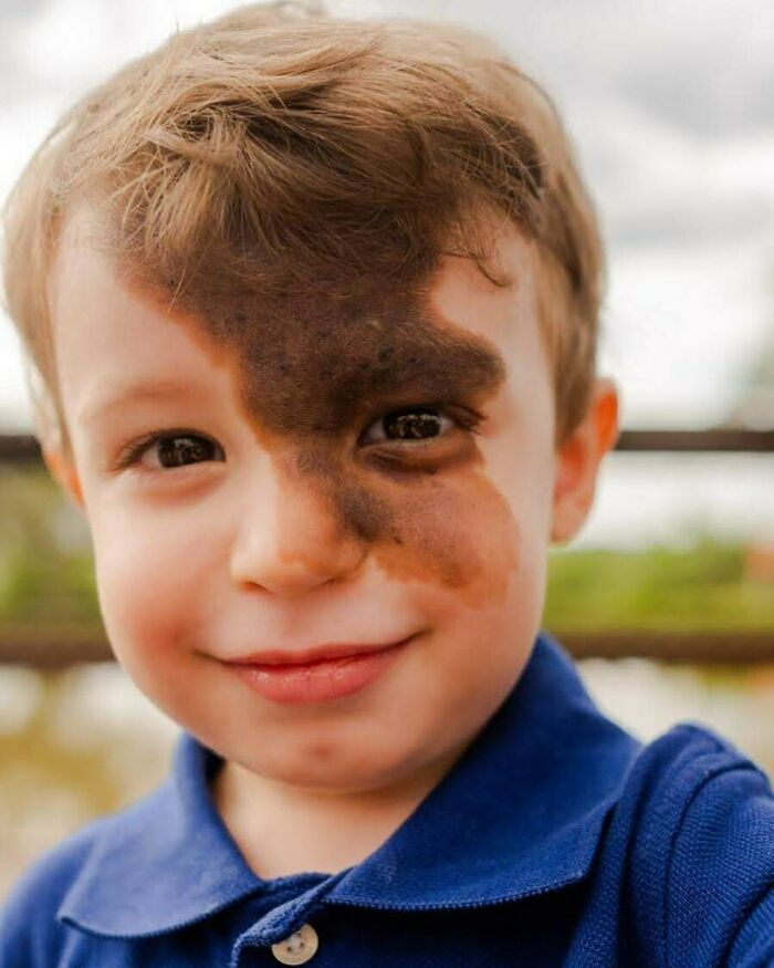 Unique Birthmark