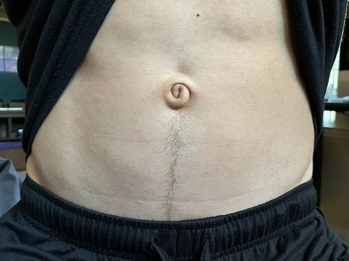 Swirly Outie Belly Button