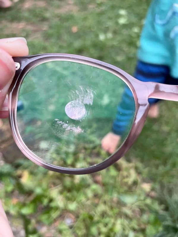 “My kid slapped my glasses directly into my eyeball”