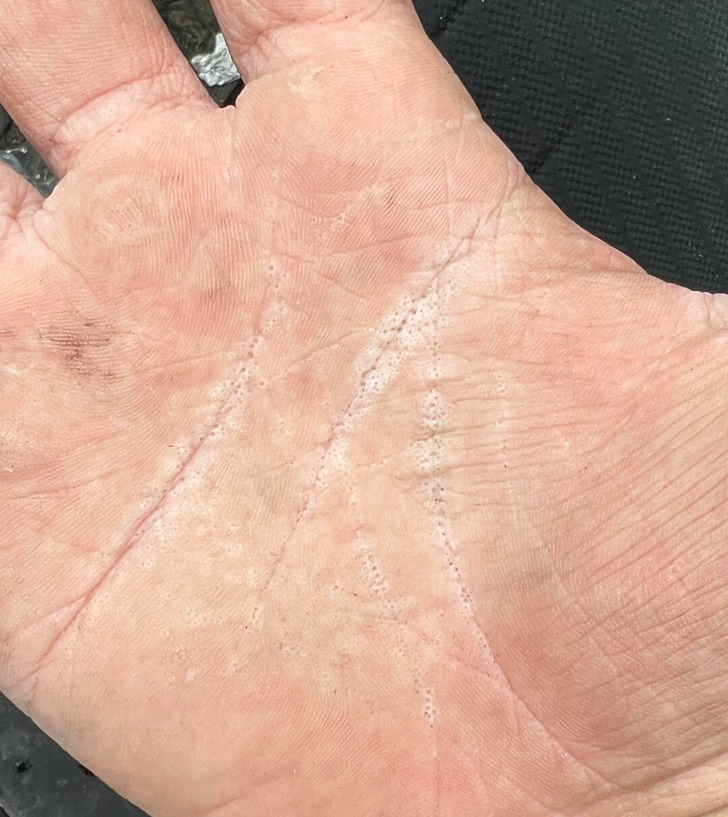 “My hand had a million small holes after a day working construction in the rain.”