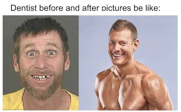 funny pics - head - Dentist before and after pictures be